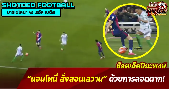 แอนโทนี่ลอดดาก